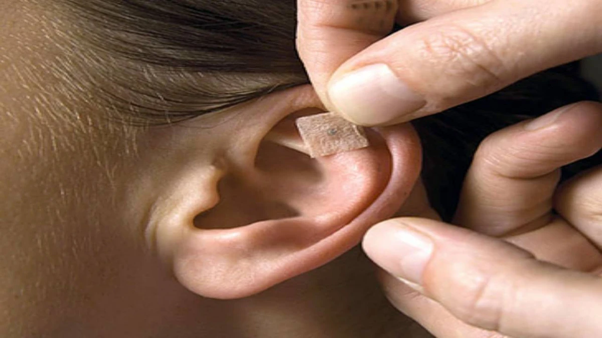 Auriculoterapia